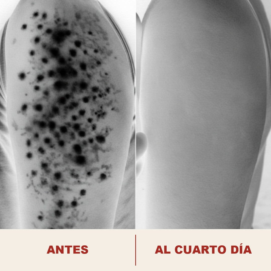 Acercamiento del poro antes y al cuarto dia