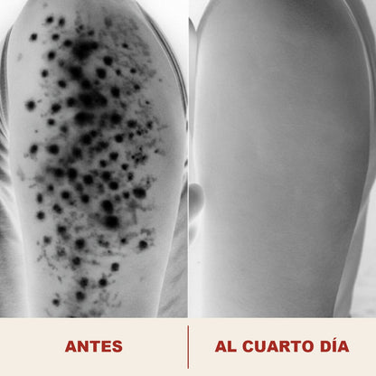 Acercamiento del poro antes y al cuarto dia