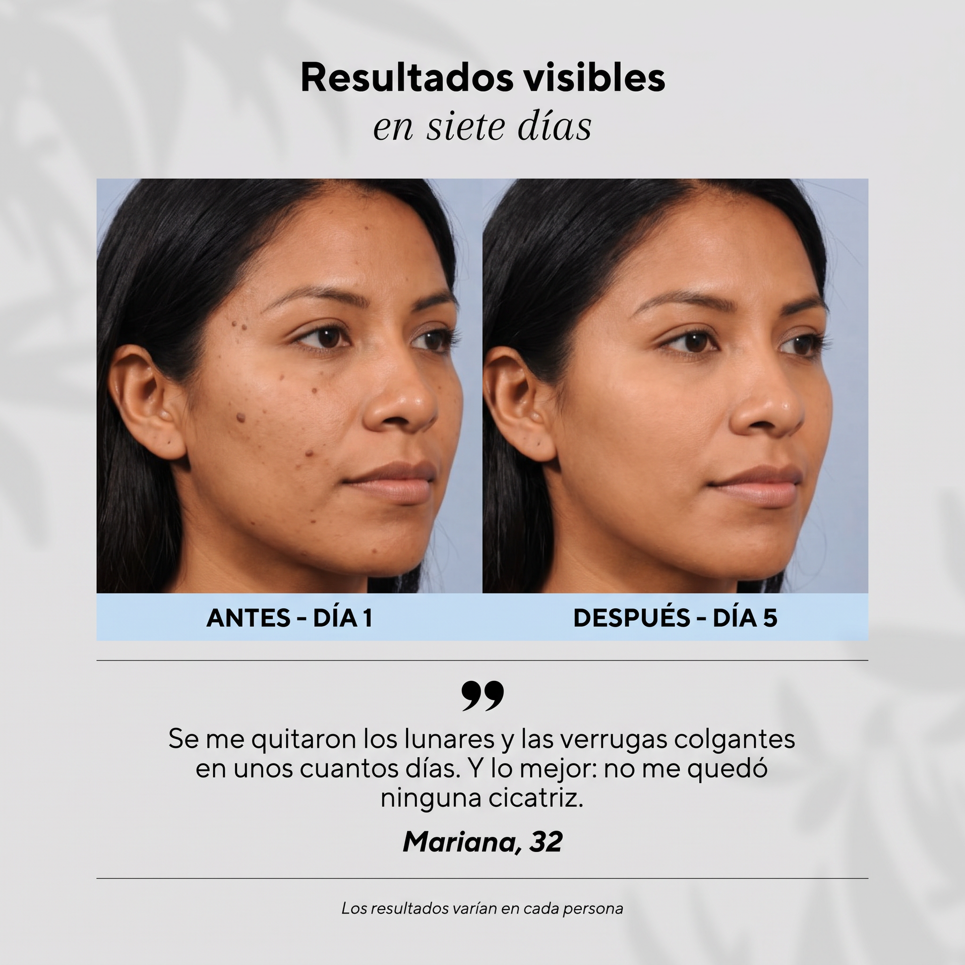 Resultados visibles en siete días, antes y después