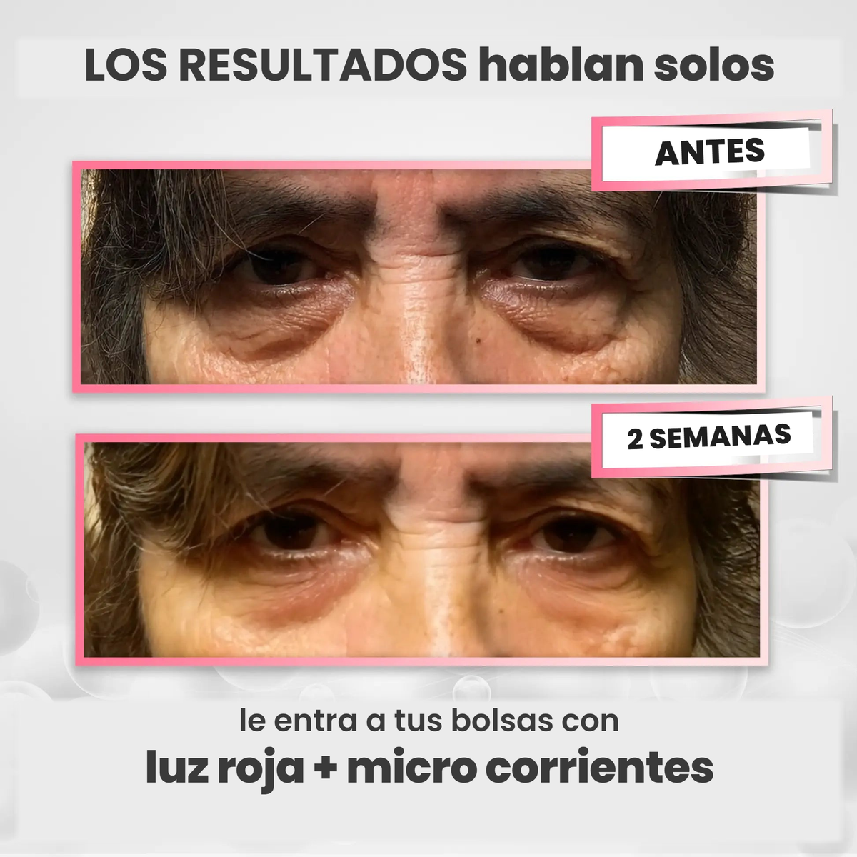 Antes y a las dos semanas de usar Nivora RevitalEyes